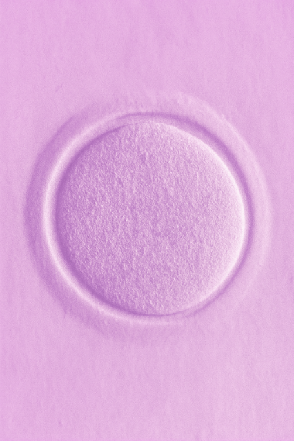 Oocyte Storage image