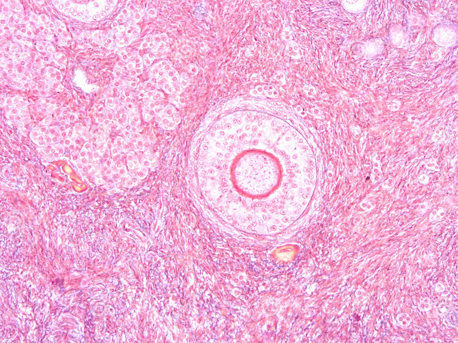 Ovarian Tissue Storage image